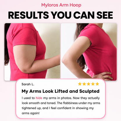 Myloros Arm Hoop™